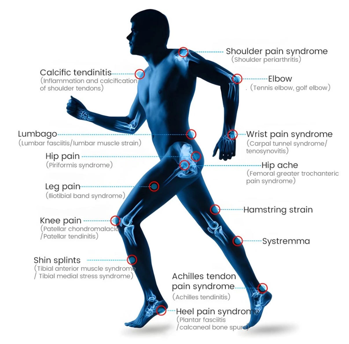 Focused shockwave therapy device delivering targeted acoustic energy to soft tissue injury