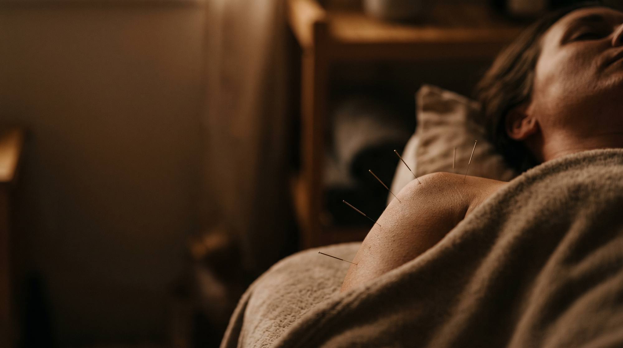 acupuncture treatment peoria